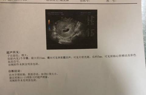 journal_insert_pic_1686961236
