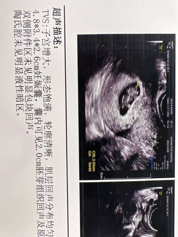 journal_insert_pic_1688823084