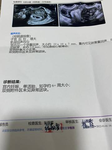 journal_insert_pic_1690299410