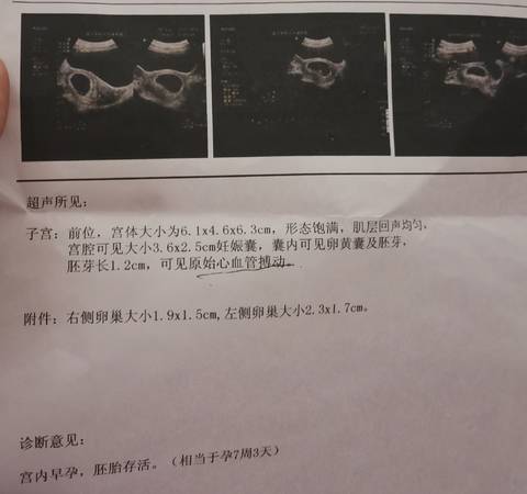 journal_insert_pic_1689256795