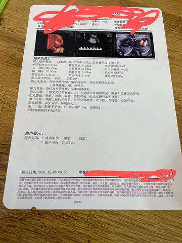 journal_insert_pic_1675606299