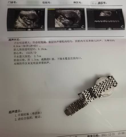 journal_insert_pic_1685400592