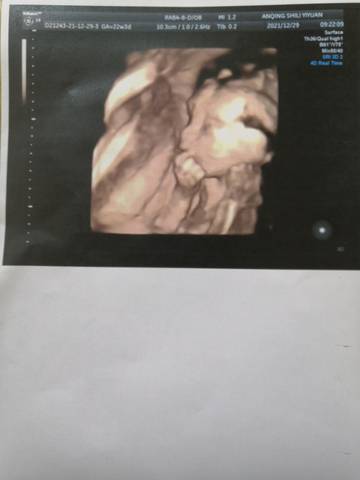 journal_insert_pic_1688173039
