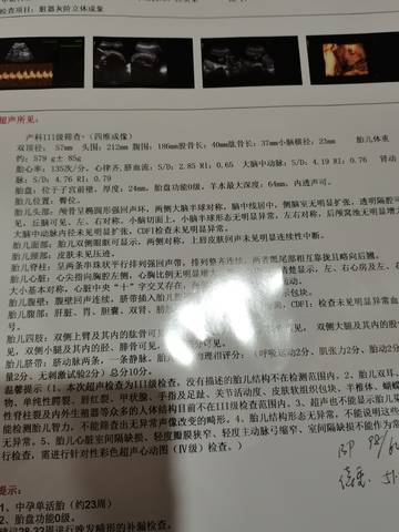 journal_insert_pic_1683224867