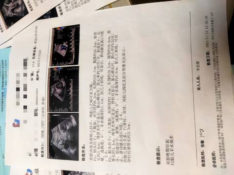 journal_insert_pic_1688639449