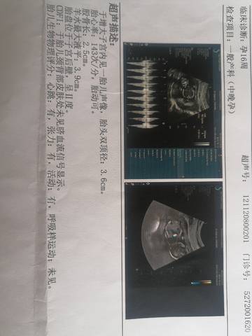 journal_insert_pic_1676552499