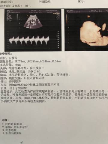 journal_insert_pic_1676611728