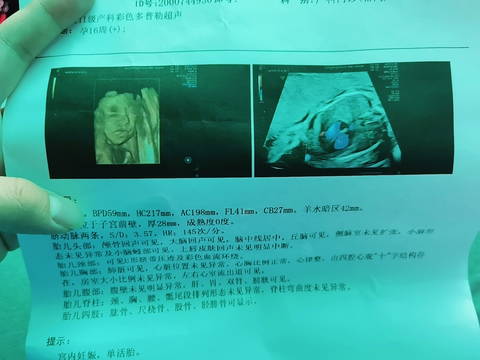 journal_insert_pic_1683001156