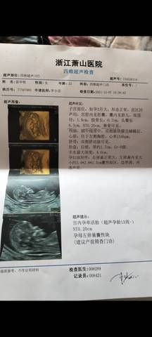 journal_insert_pic_1676673365