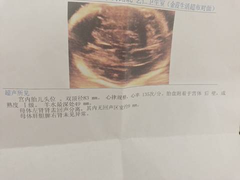 journal_insert_pic_1673434215