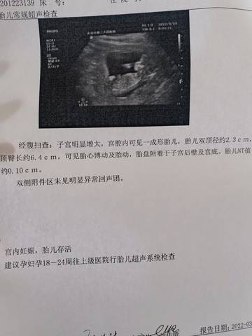 journal_insert_pic_1740843892