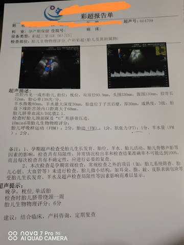 journal_insert_pic_1678593569
