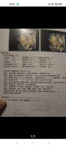 journal_insert_pic_1676958297