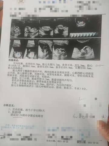 journal_insert_pic_1675106759