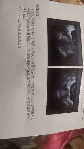 journal_insert_pic_1683683747