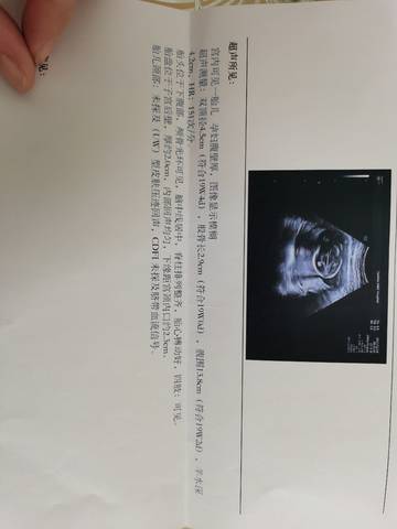 journal_insert_pic_1685176320