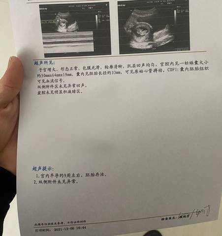 journal_insert_pic_1674752041
