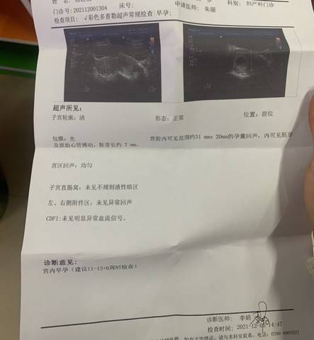 journal_insert_pic_1674443242