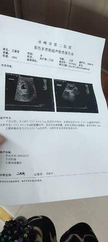 journal_insert_pic_1675352449