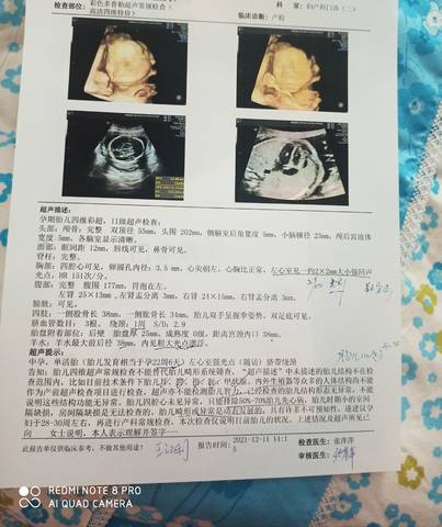 journal_insert_pic_1678180842