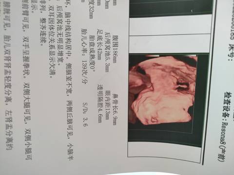 journal_insert_pic_1740888496