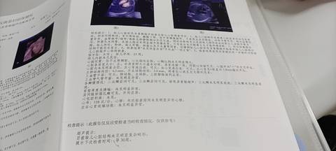 journal_insert_pic_1674599336