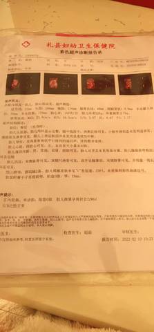 journal_insert_pic_1719383497