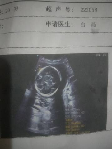 journal_insert_pic_1679875571