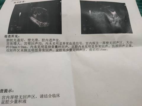 journal_insert_pic_1690040559
