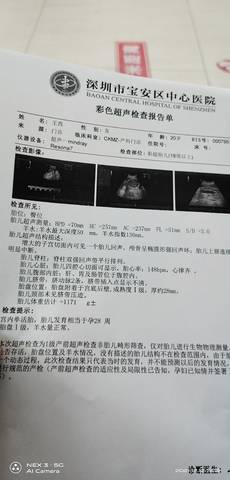 journal_insert_pic_1678572844