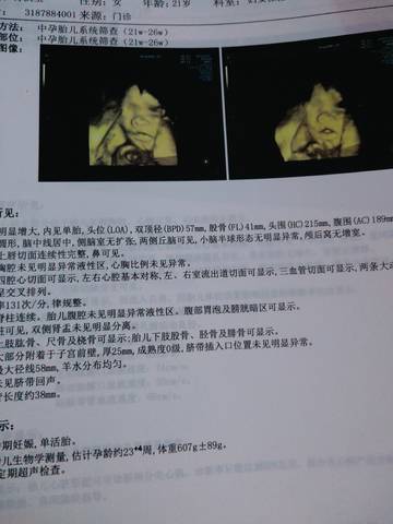 journal_insert_pic_1687247262