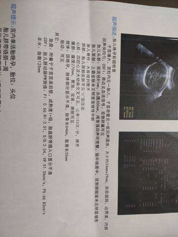 journal_insert_pic_1719735776