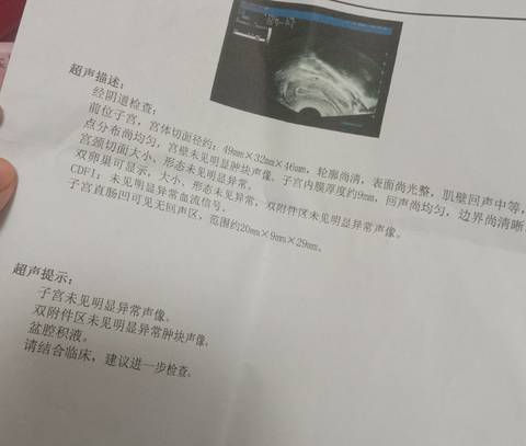 journal_insert_pic_1681235339