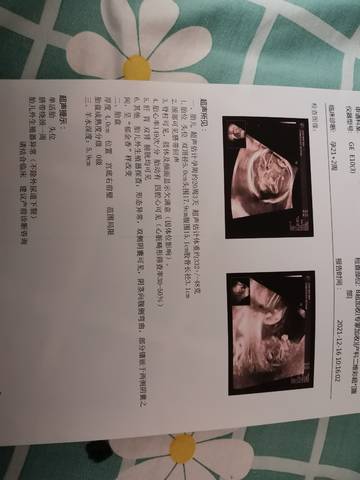 journal_insert_pic_1684842490