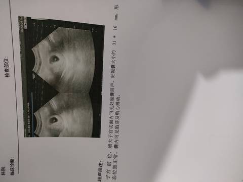 journal_insert_pic_1682072208