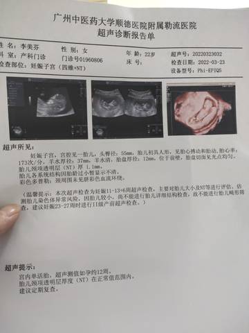 journal_insert_pic_1740811825
