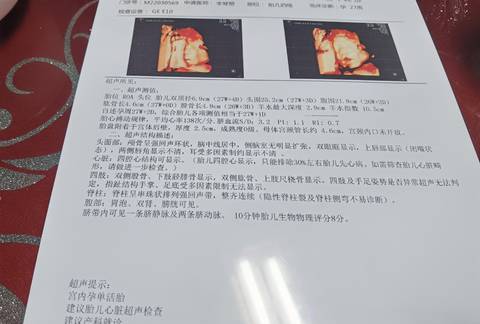 journal_insert_pic_1673289751