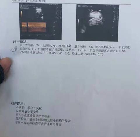 journal_insert_pic_1689522264