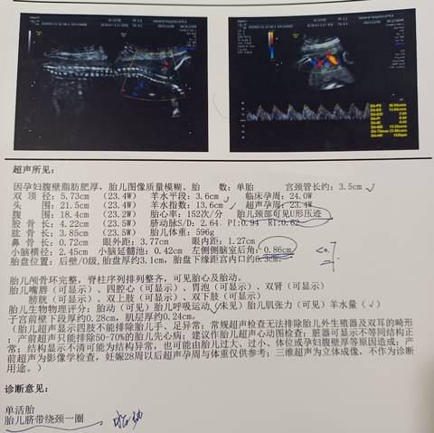 journal_insert_pic_1674933516
