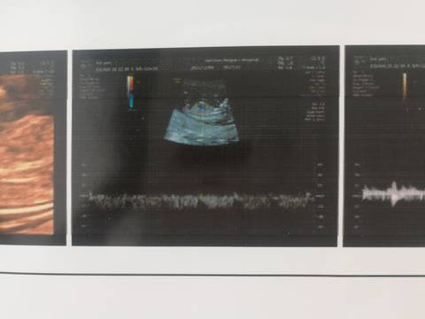 journal_insert_pic_1673511084