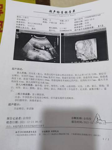 journal_insert_pic_1679541021