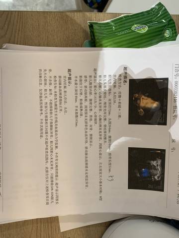 journal_insert_pic_1720017361