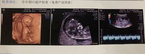 journal_insert_pic_1680024823