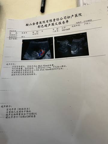 journal_insert_pic_1683115027