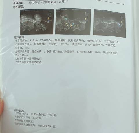 journal_insert_pic_1740891522