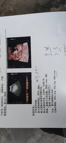 journal_insert_pic_1682401496