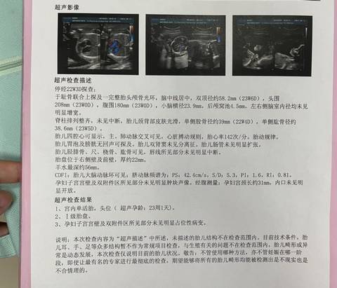 journal_insert_pic_1675269461