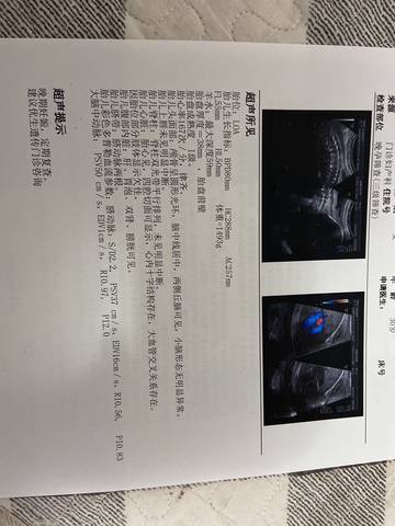 journal_insert_pic_1687236352