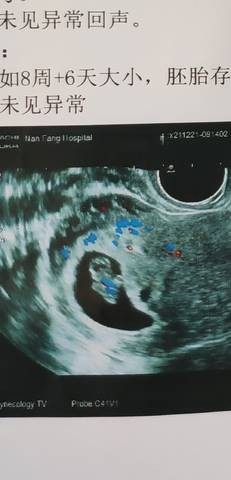 journal_insert_pic_1683742544