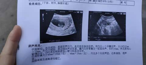 journal_insert_pic_1676160938